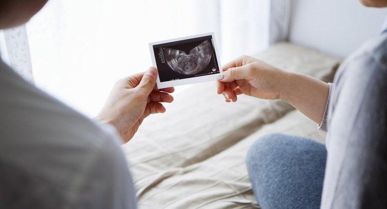 Comment pouvez-vous déterminer si un fœtus est un homme ou une femme ?
