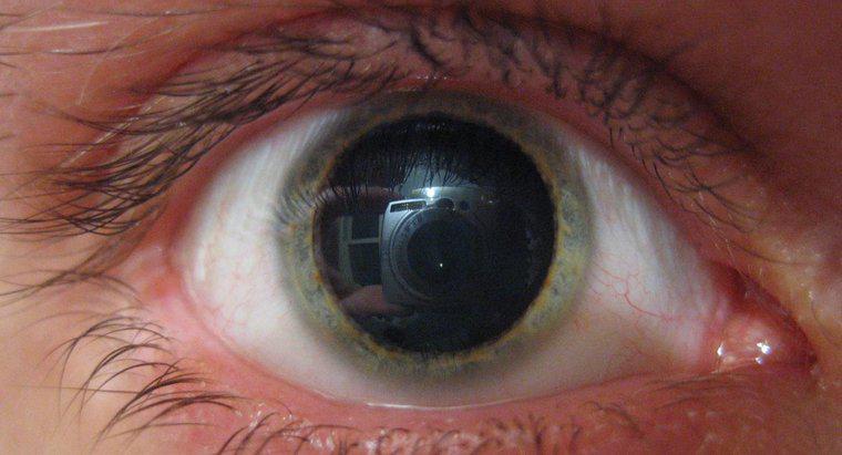 Qu'est-ce qui peut causer des pupilles dilatées ?