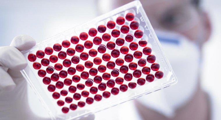 Que signifie un faible MPV dans un test sanguin?